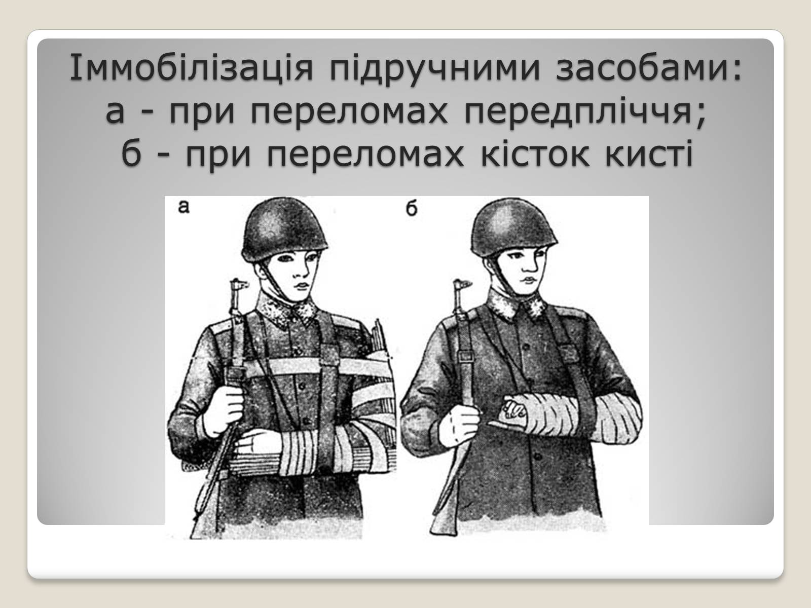 Презентація на тему «Іммобілізація ушкодженої ділянки тіла» - Слайд #2