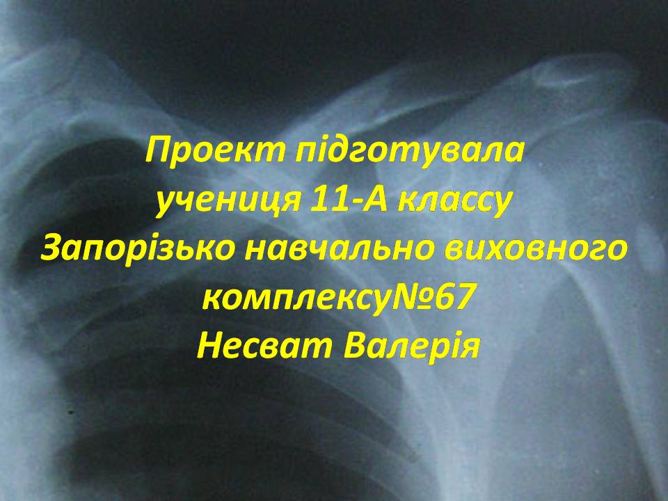 Презентація на тему «Правила надання першої допомоги ?при переломах» - Слайд #1