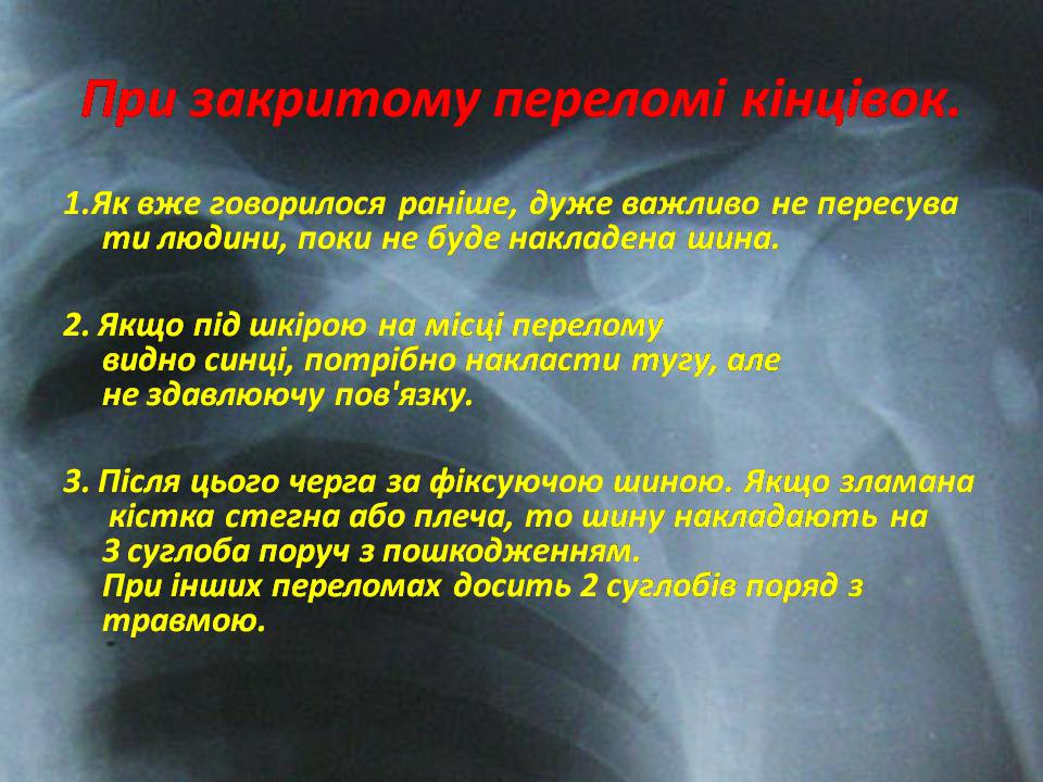Презентація на тему «Правила надання першої допомоги ?при переломах» - Слайд #12