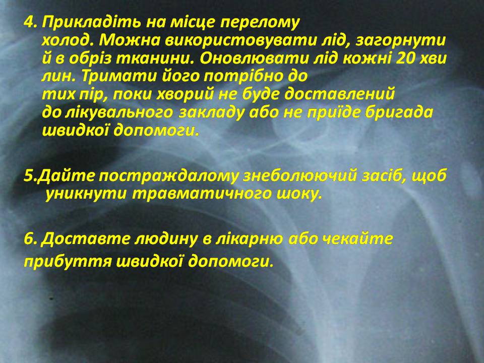 Презентація на тему «Правила надання першої допомоги ?при переломах» - Слайд #13