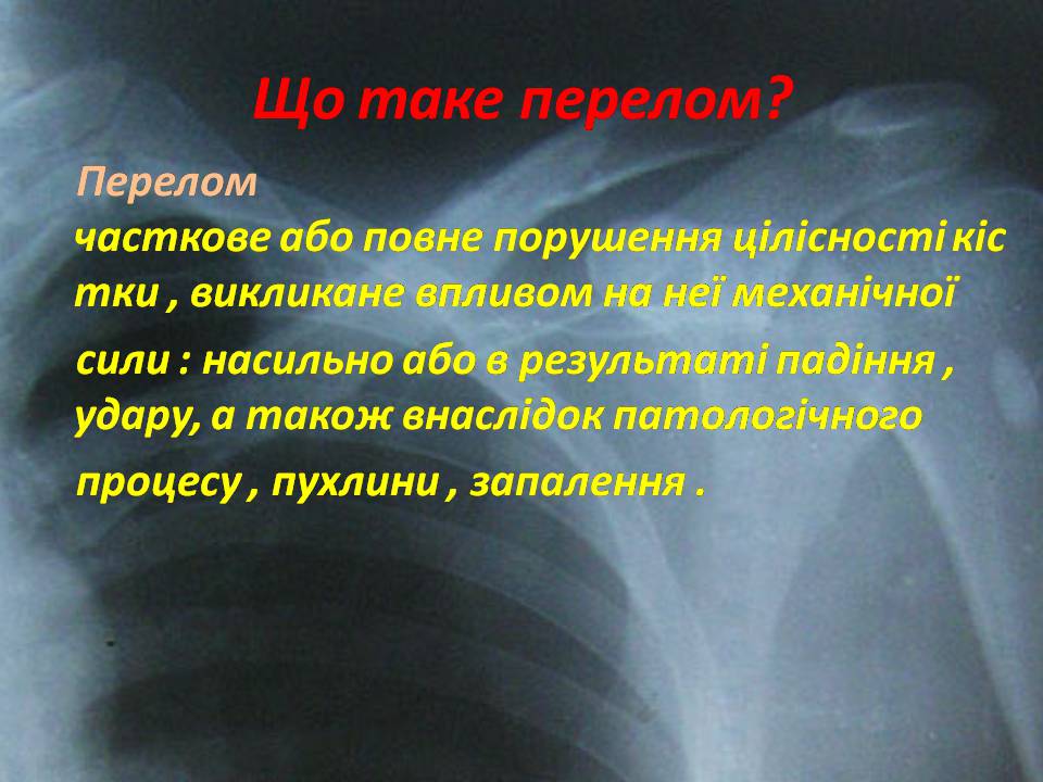 Презентація на тему «Правила надання першої допомоги ?при переломах» - Слайд #4