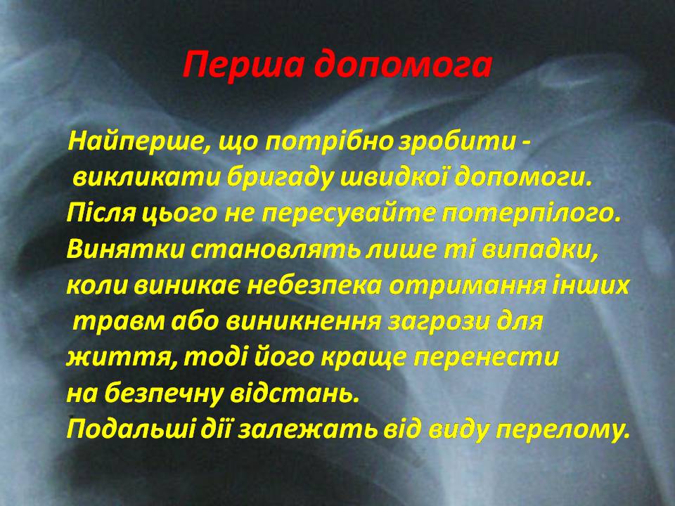 Презентація на тему «Правила надання першої допомоги ?при переломах» - Слайд #8