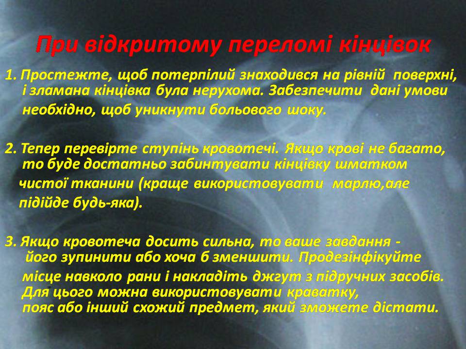 Презентація на тему «Правила надання першої допомоги ?при переломах» - Слайд #9