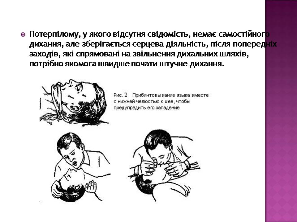 Презентація на тему «Перша допомога при утопленні» (варіант 4) - Слайд #9