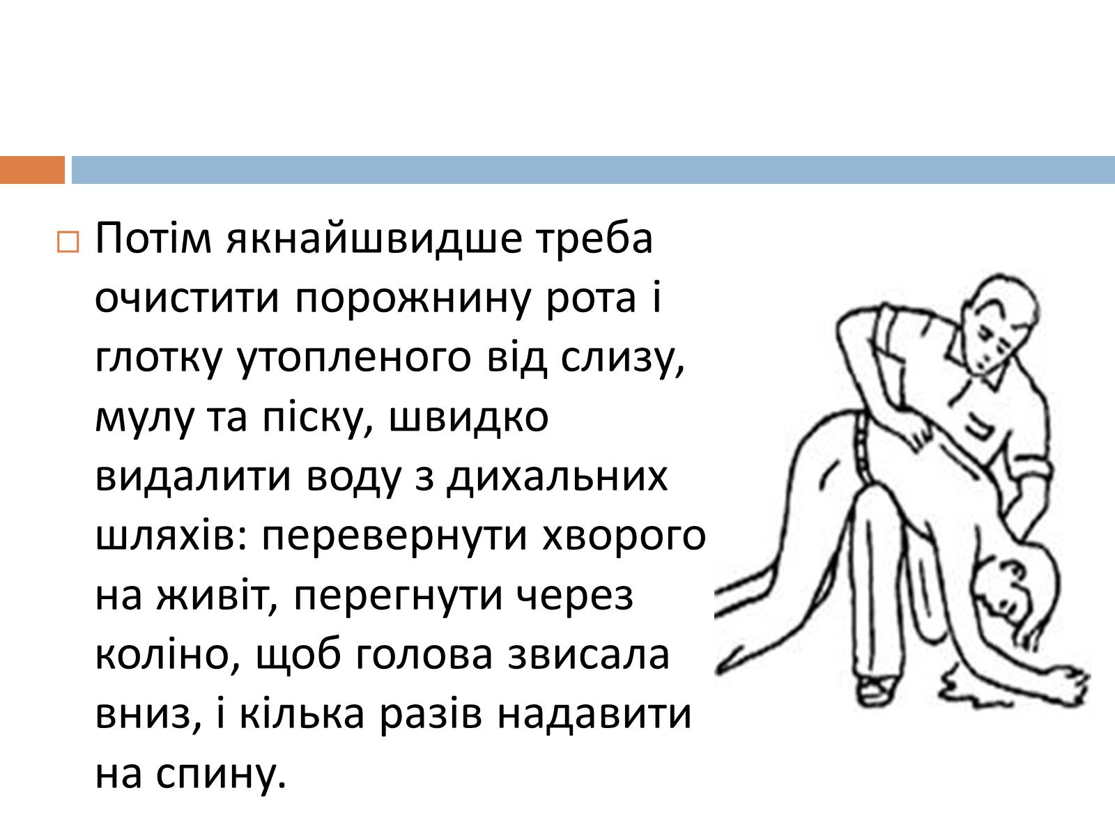 Презентація на тему «Дії рятівника під час першої допомоги при утопленні» - Слайд #3