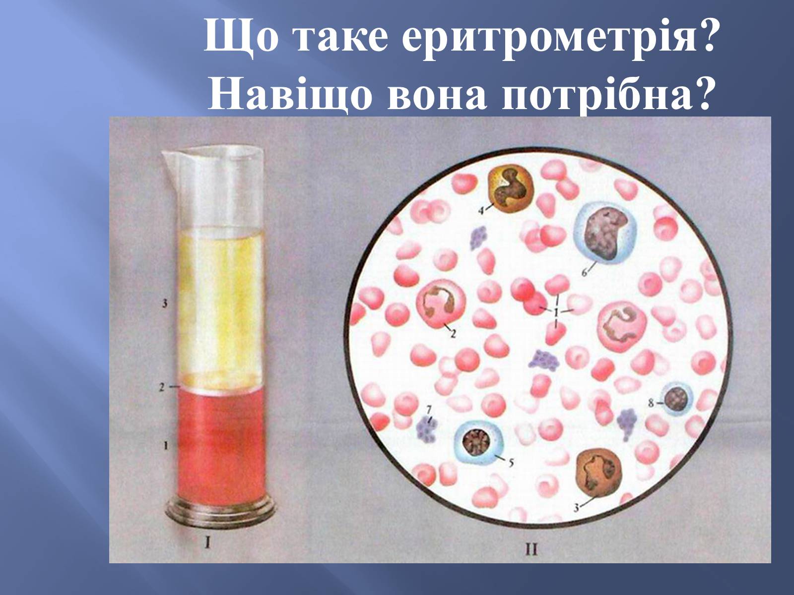 Презентація на тему «Еритрометрія» - Слайд #2