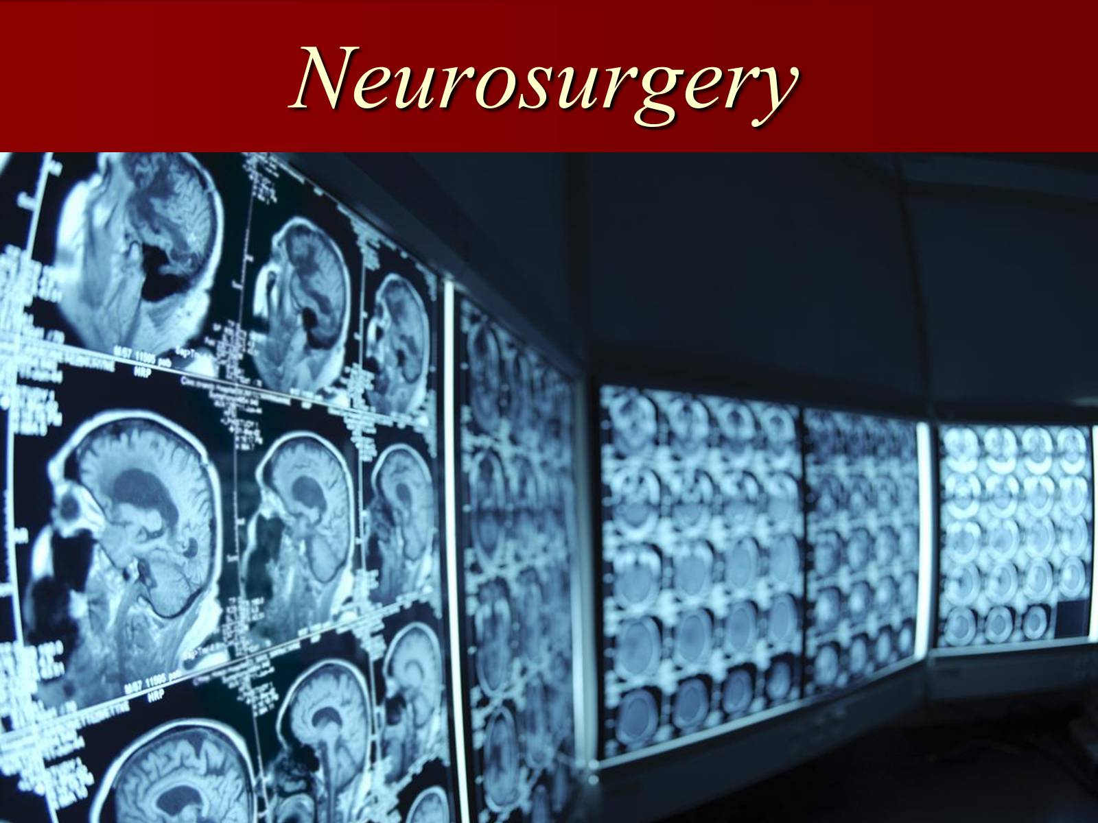 Презентація на тему «Neurosurgery» - Слайд #1