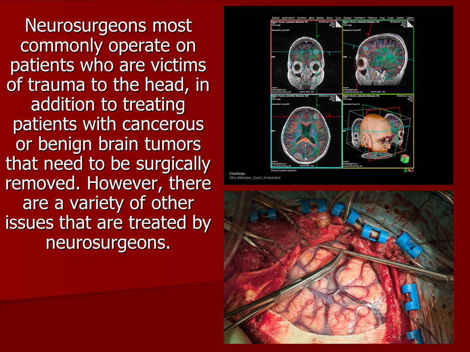 Презентація на тему «Neurosurgery» - Слайд #4