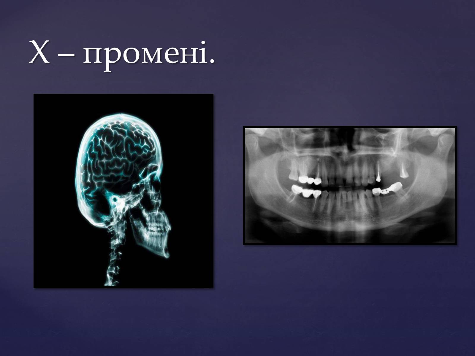 Презентація на тему «Електромагнітні хвилі в природі і техніці» (варіант 4) - Слайд #20