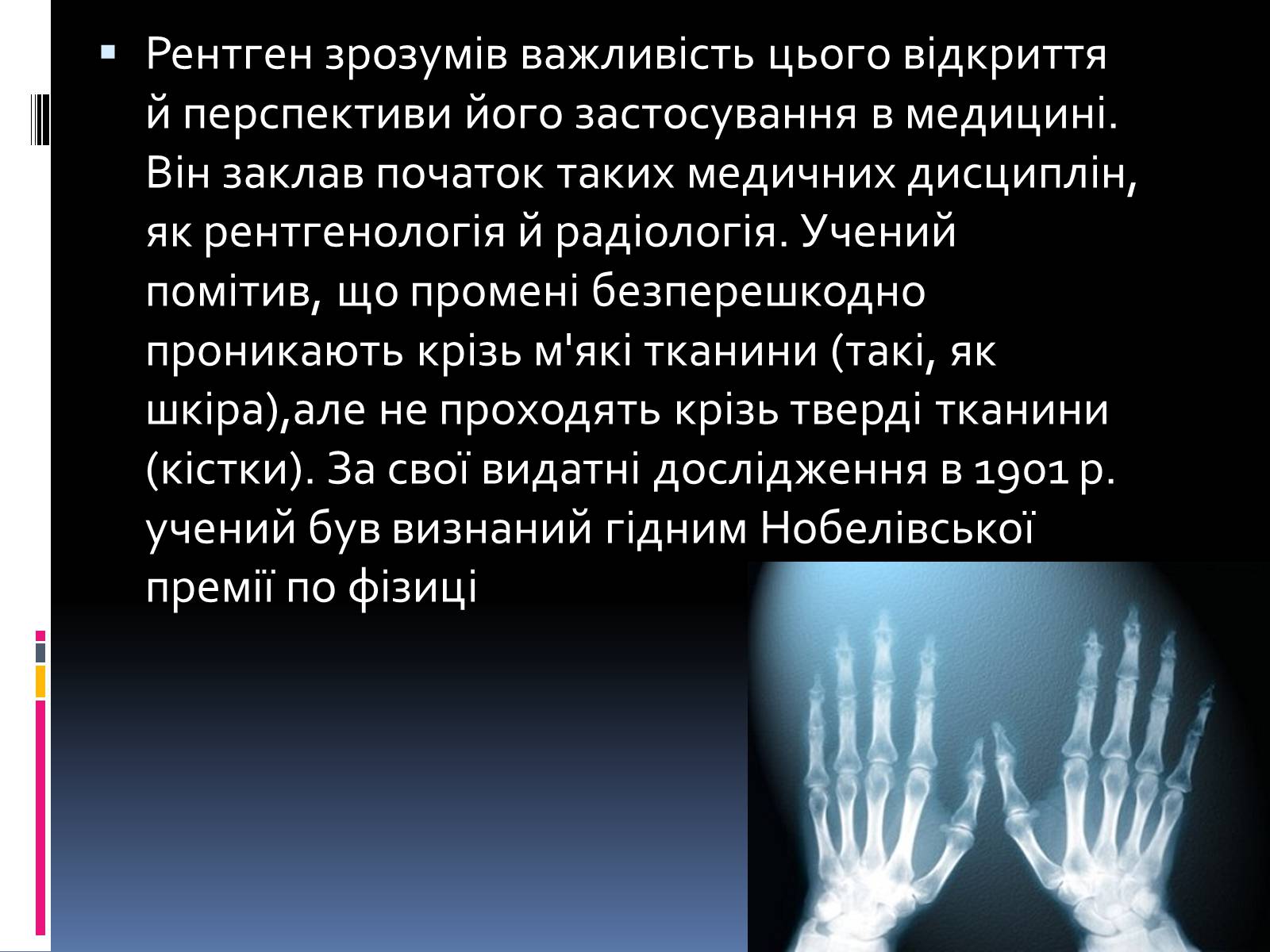 Презентація на тему «Рентгенівське випромінювання» (варіант 1) - Слайд #4