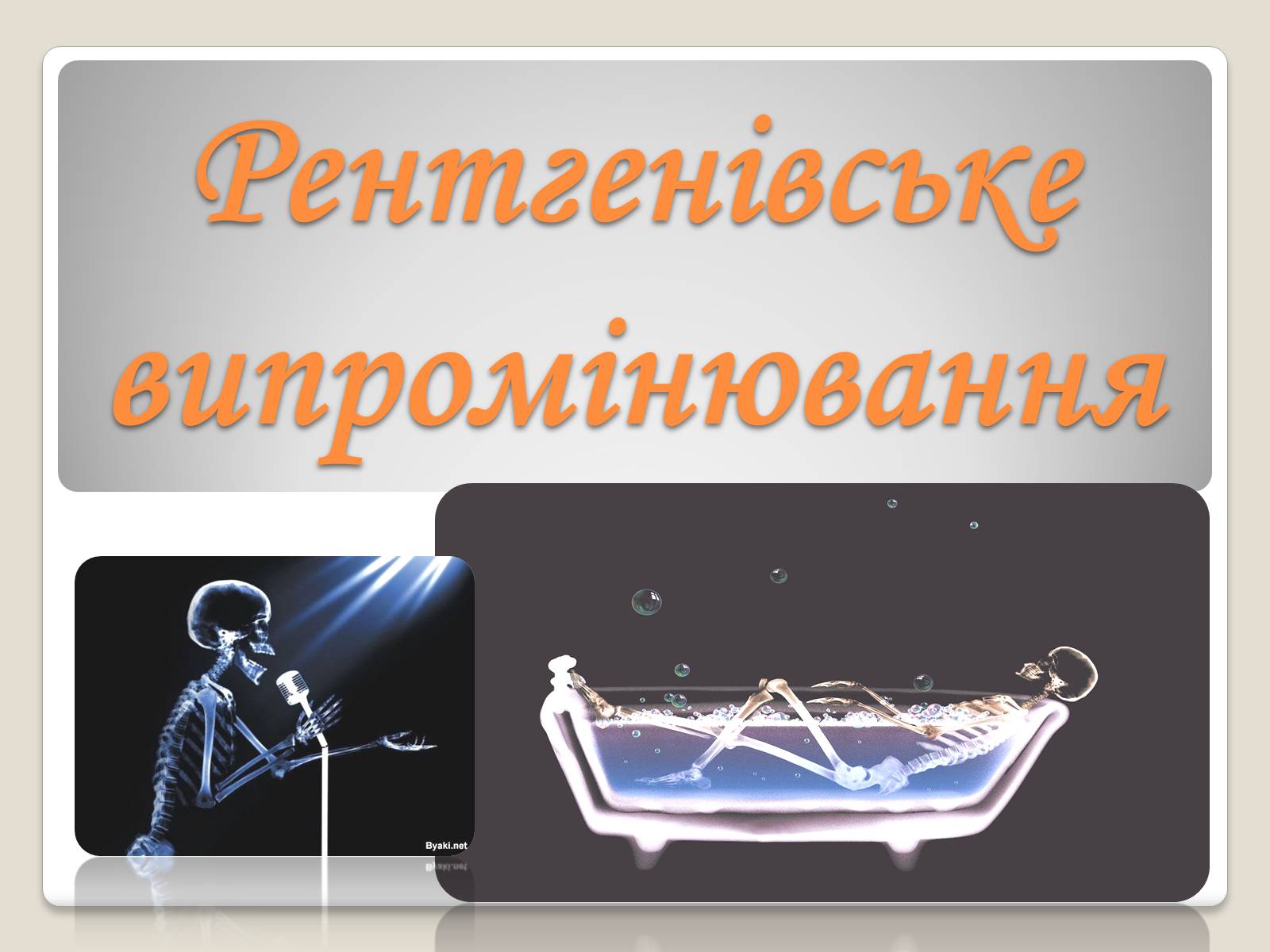 Презентація на тему «Рентгенівське випромінювання» (варіант 11) - Слайд #1