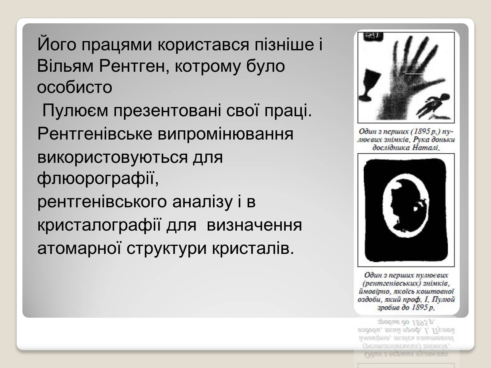 Презентація на тему «Рентгенівське випромінювання» (варіант 11) - Слайд #5