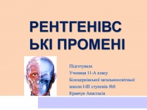 Презентація на тему «Рентгенівські промені»