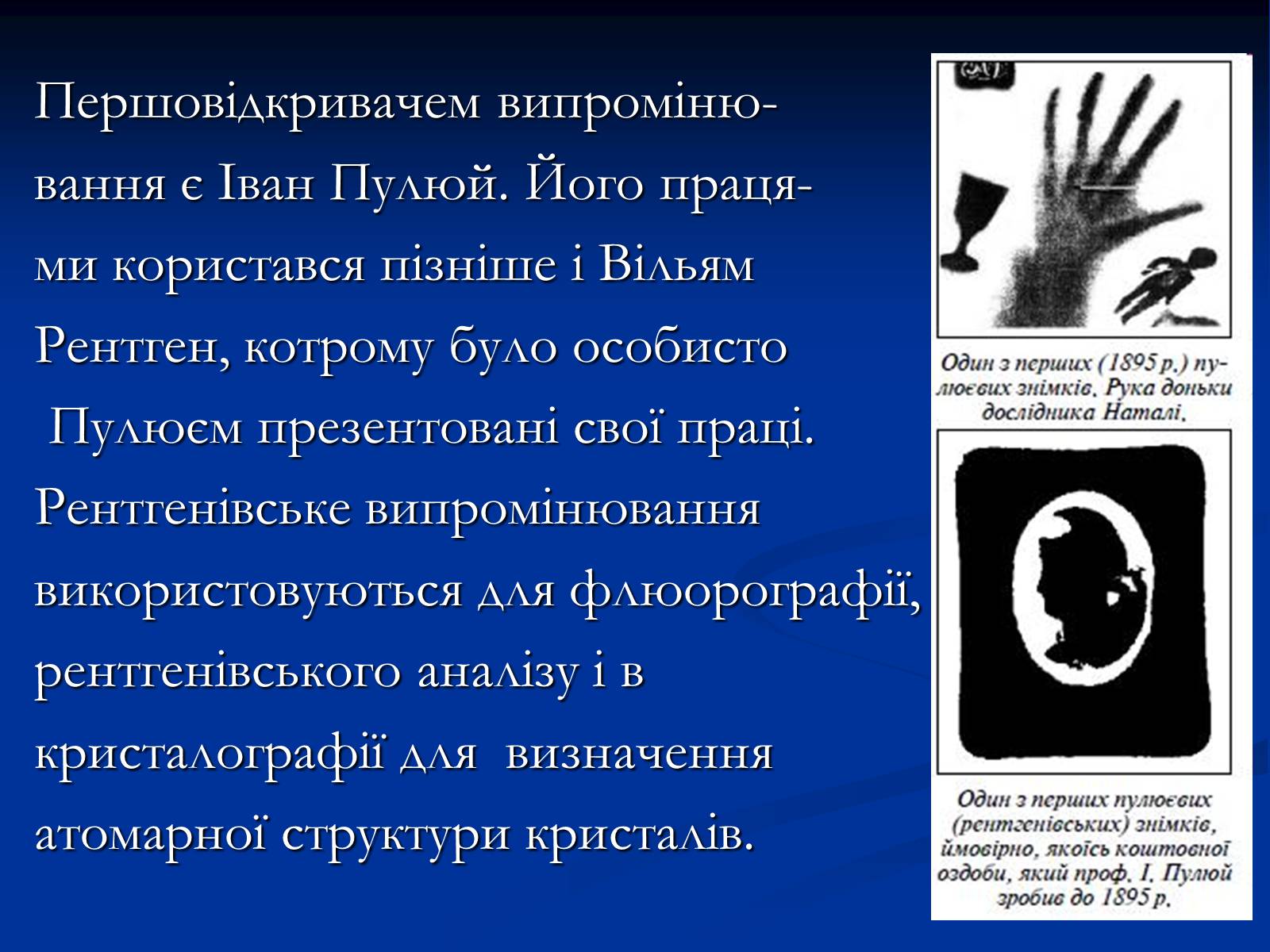 Презентація на тему «Рентгенівське випромінювання» (варіант 10) - Слайд #6