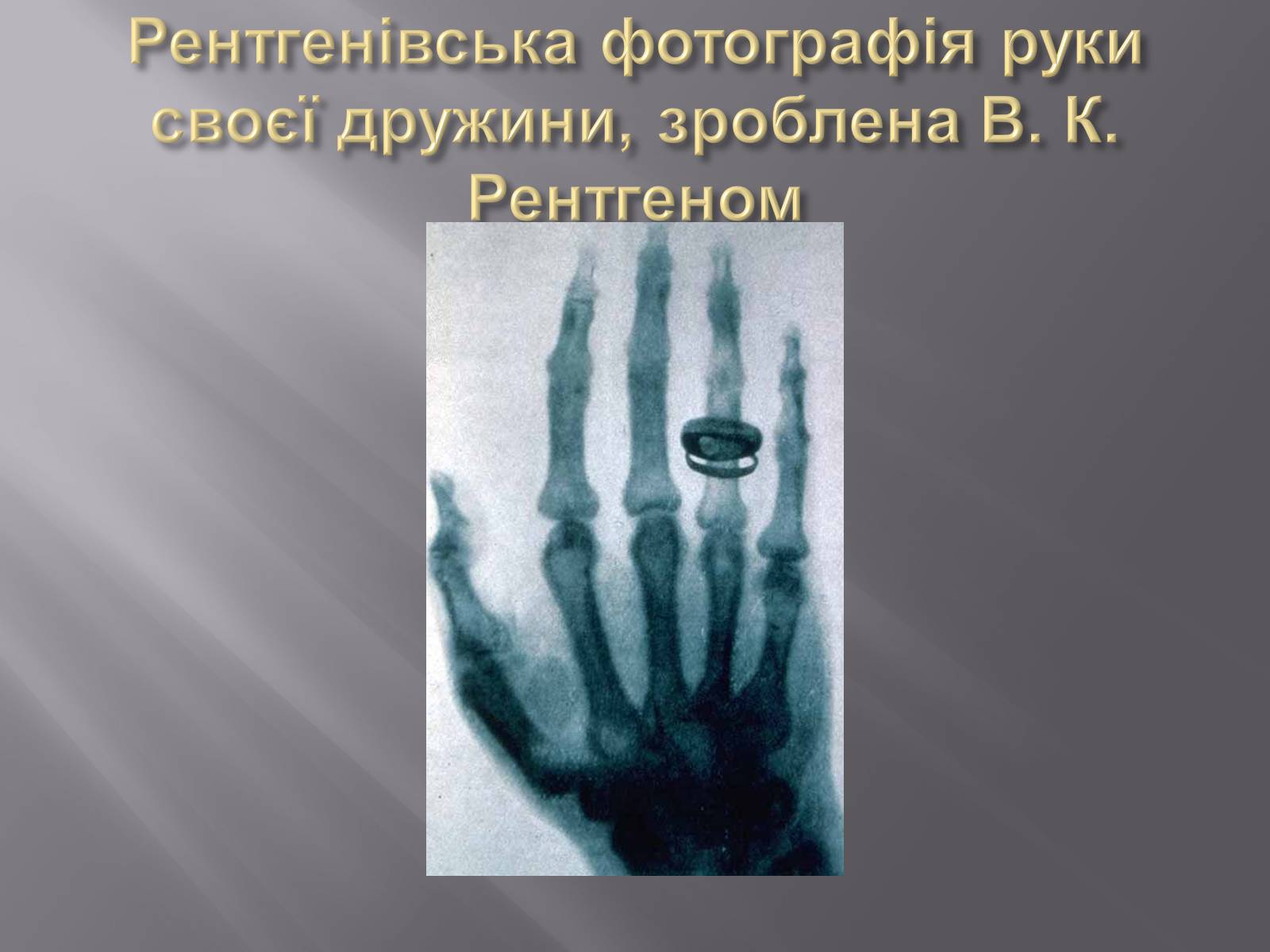 Презентація на тему «Рентгенівське випромінювання» (варіант 4) - Слайд #5