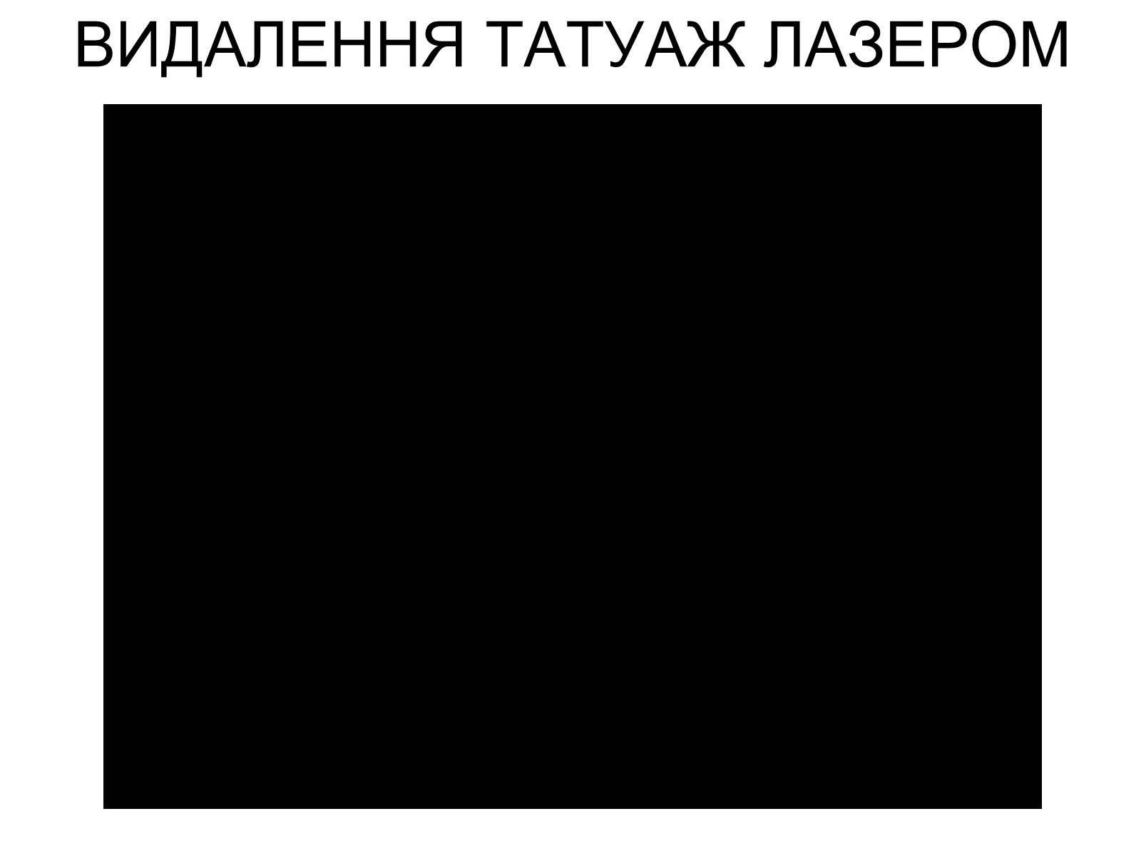 Презентація на тему «Лазери та їх застосування» (варіант 1) - Слайд #12 Презентація на тему «Лазери та їх застосування» (варіант 1) - Слайд #12