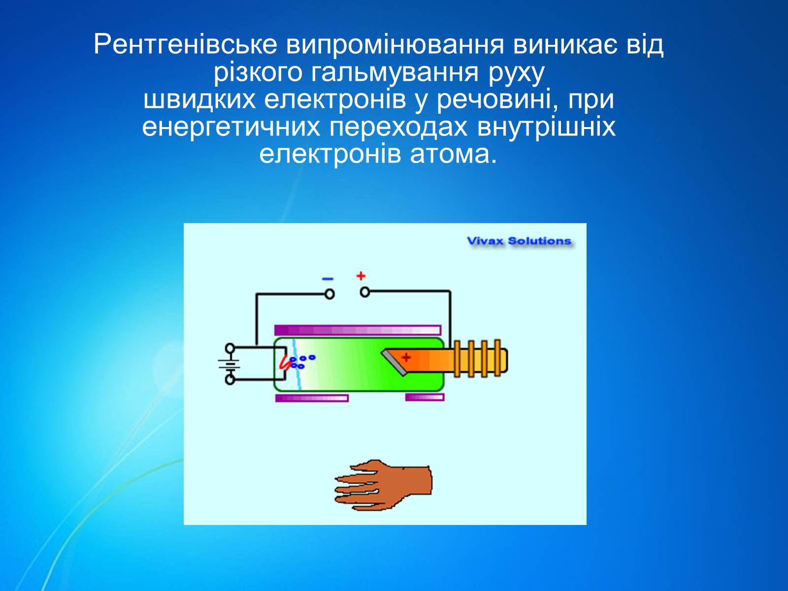 Презентація на тему «Рентгенівське випромінювання» (варіант 7) - Слайд #3