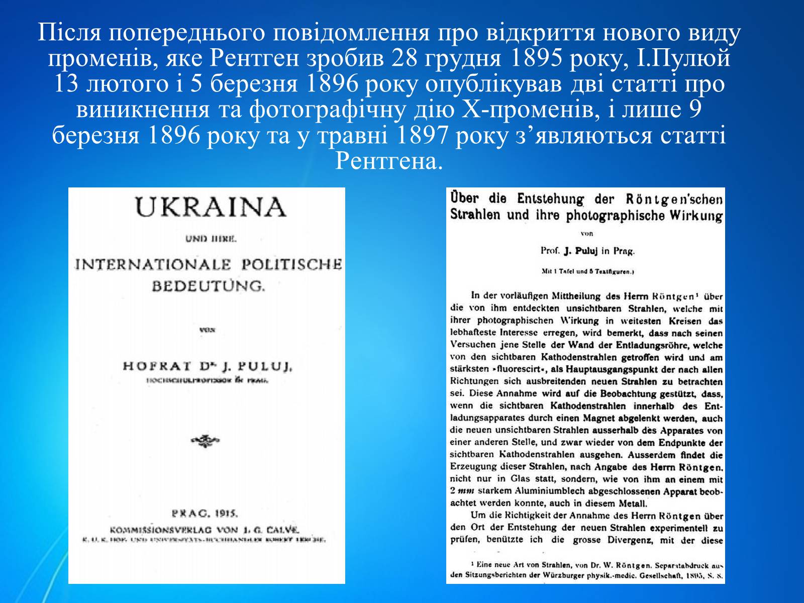 Презентація на тему «Рентгенівське випромінювання» (варіант 7) - Слайд #5