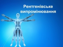 Презентація на тему «Рентгенівське випромінювання» (варіант 7)