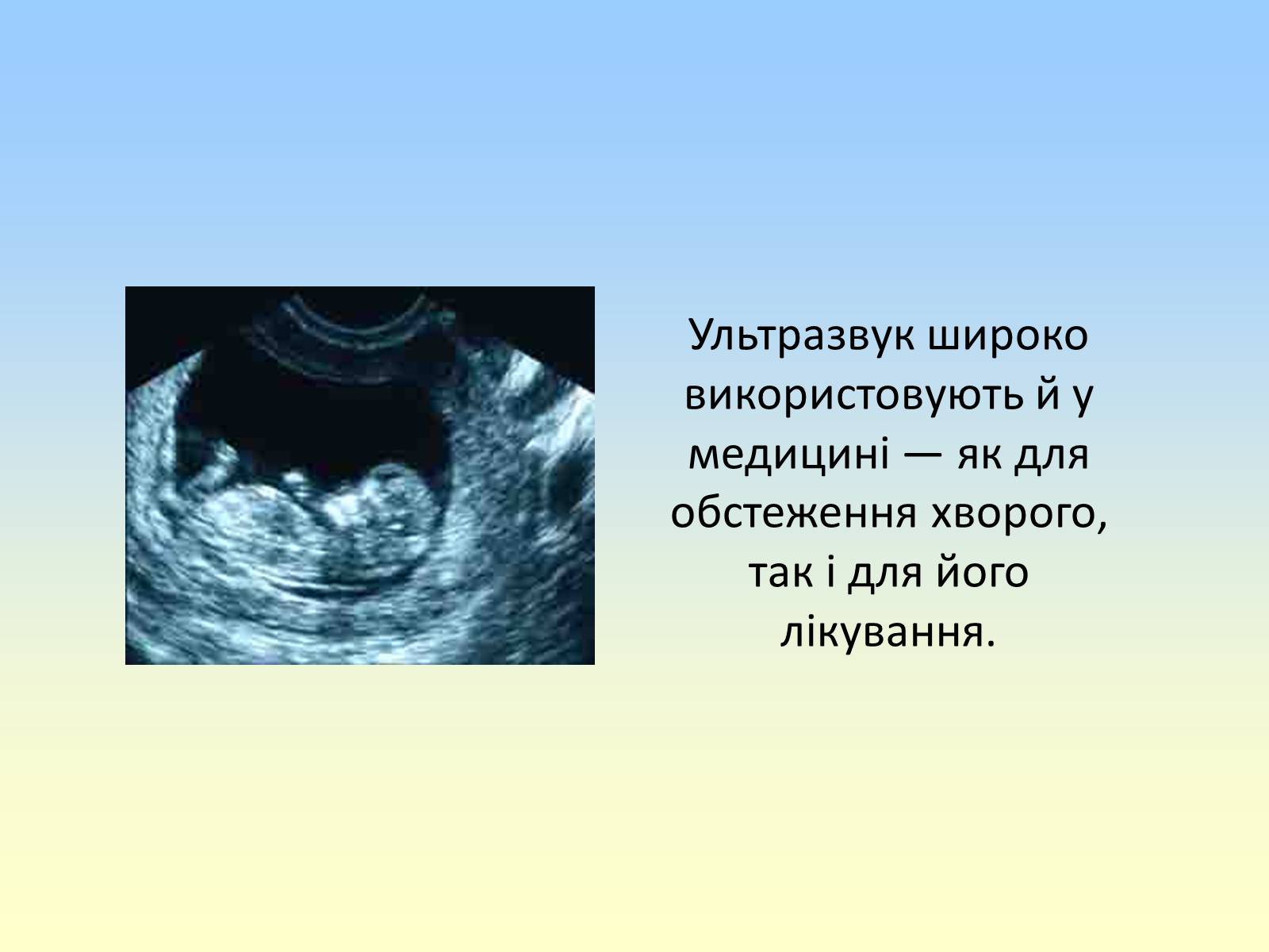 Презентація на тему «Гучність звуку. Висота і тембр звуку» - Слайд #11