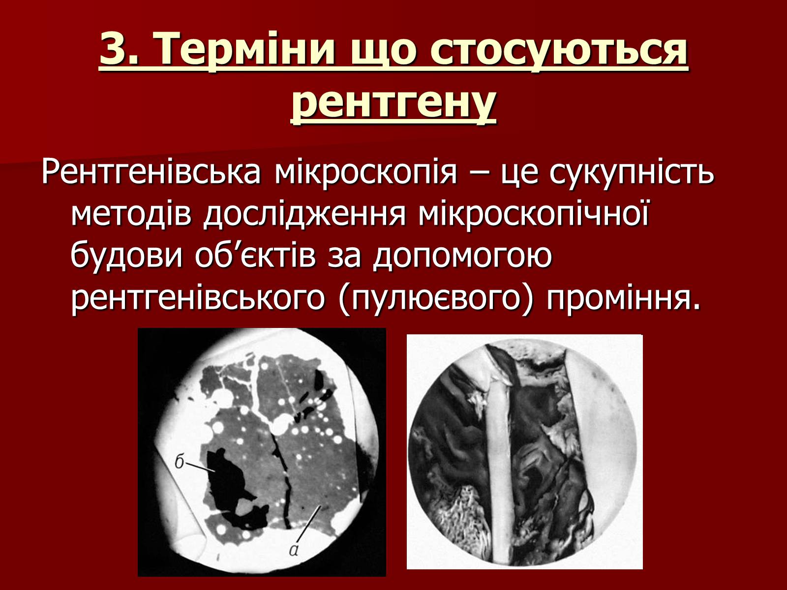 Презентація на тему «Рентгенівське випромінювання» (варіант 3) - Слайд #15