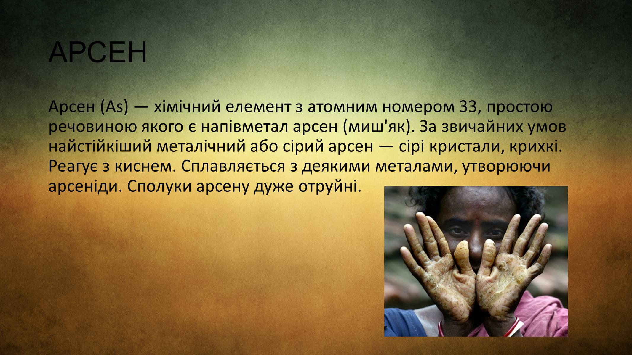 Презентація на тему «Отруєння ртуттю,кадмієм і арсеном» - Слайд #13