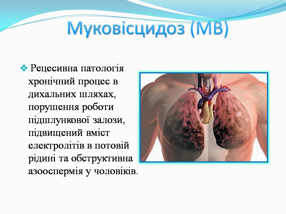 Презентація на тему «Генетичні захворювання» (варіант 2) - Слайд #7