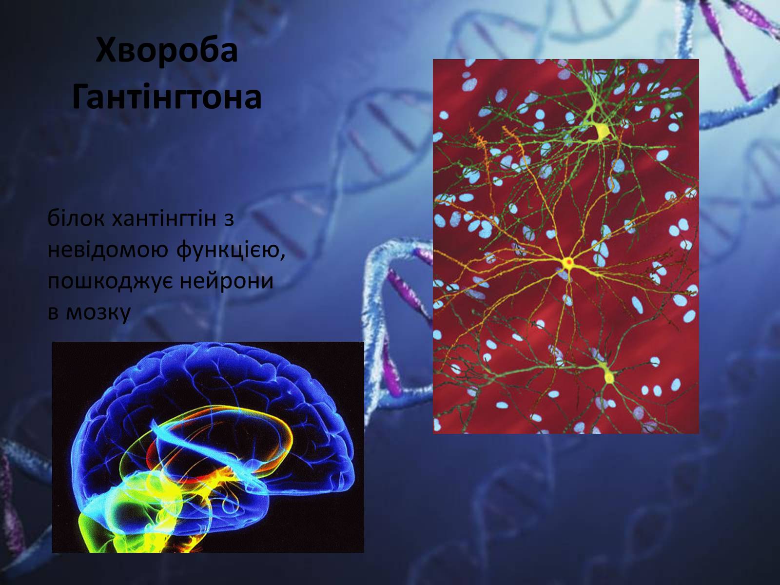 Презентація на тему «Генетичні захворювання людини» - Слайд #6