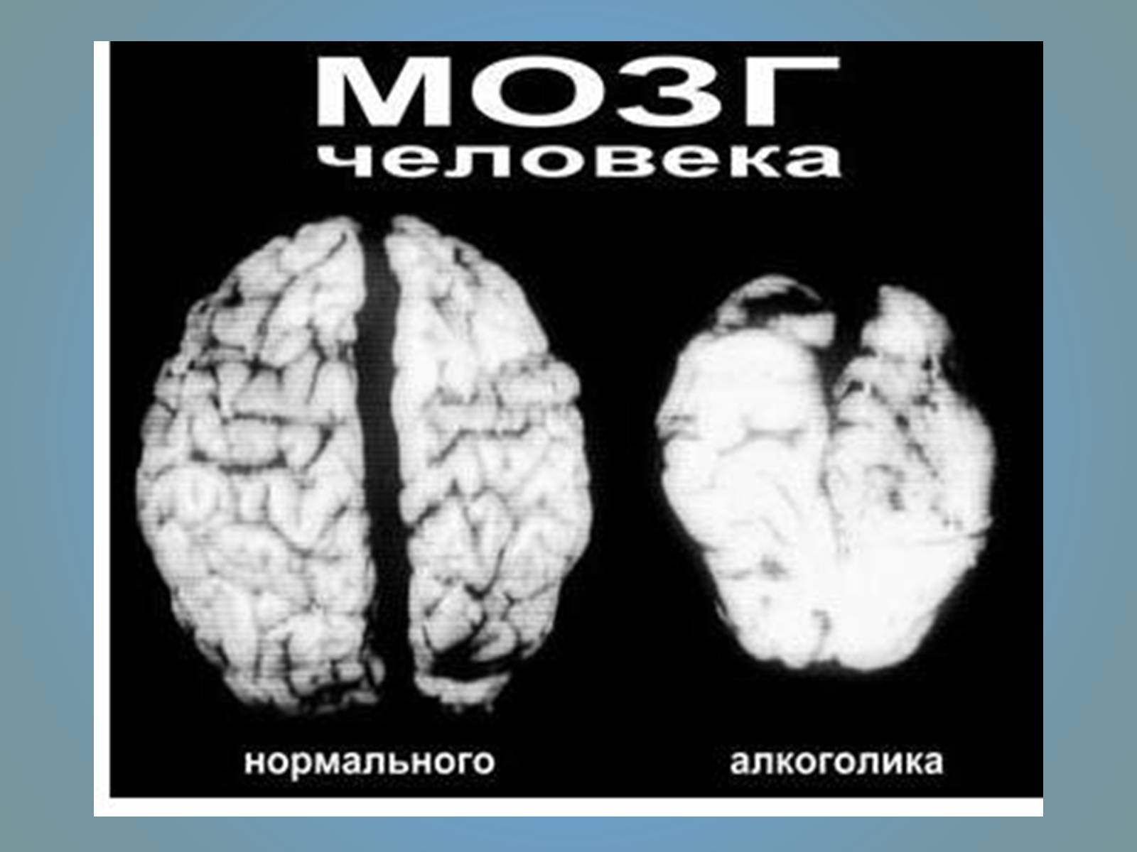 Презентація на тему «Воздействие вредных веществ на организм человека» - Слайд #21