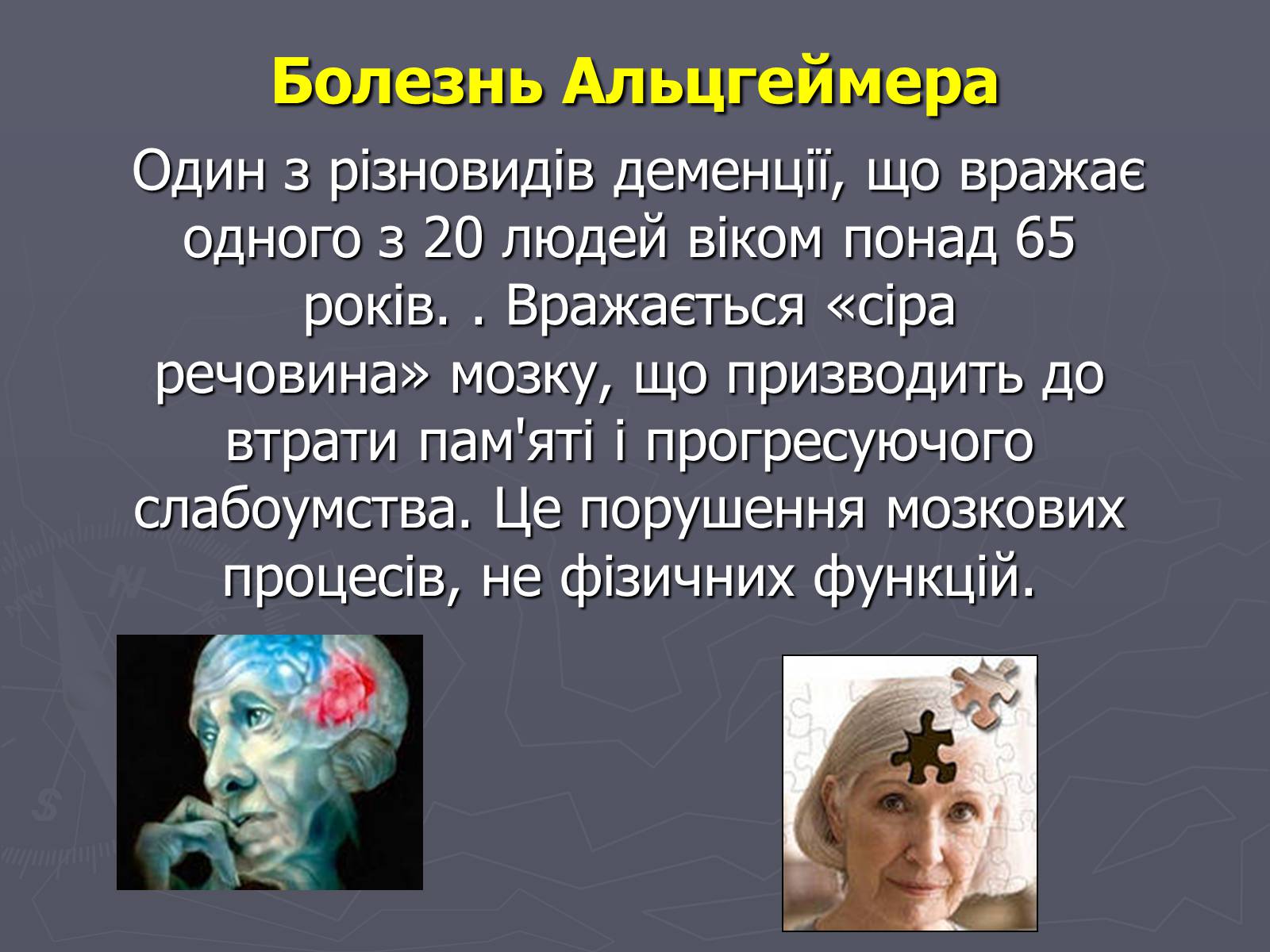 Презентація на тему «Хвороби нервової системи» - Слайд #10