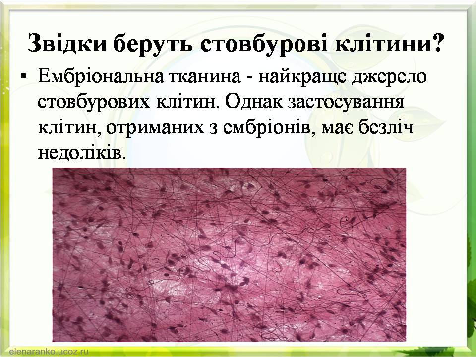 Презентація на тему «Гістотехнології.Штучні тканини» - Слайд #11