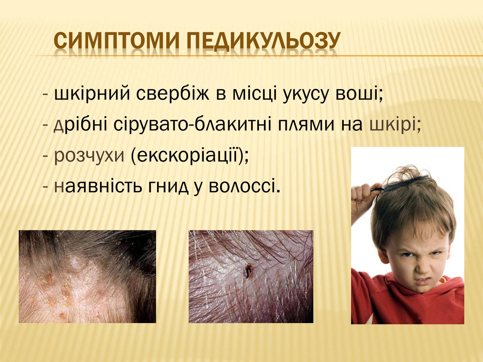 Презентація на тему «Хвороби шкіри» - Слайд #14
