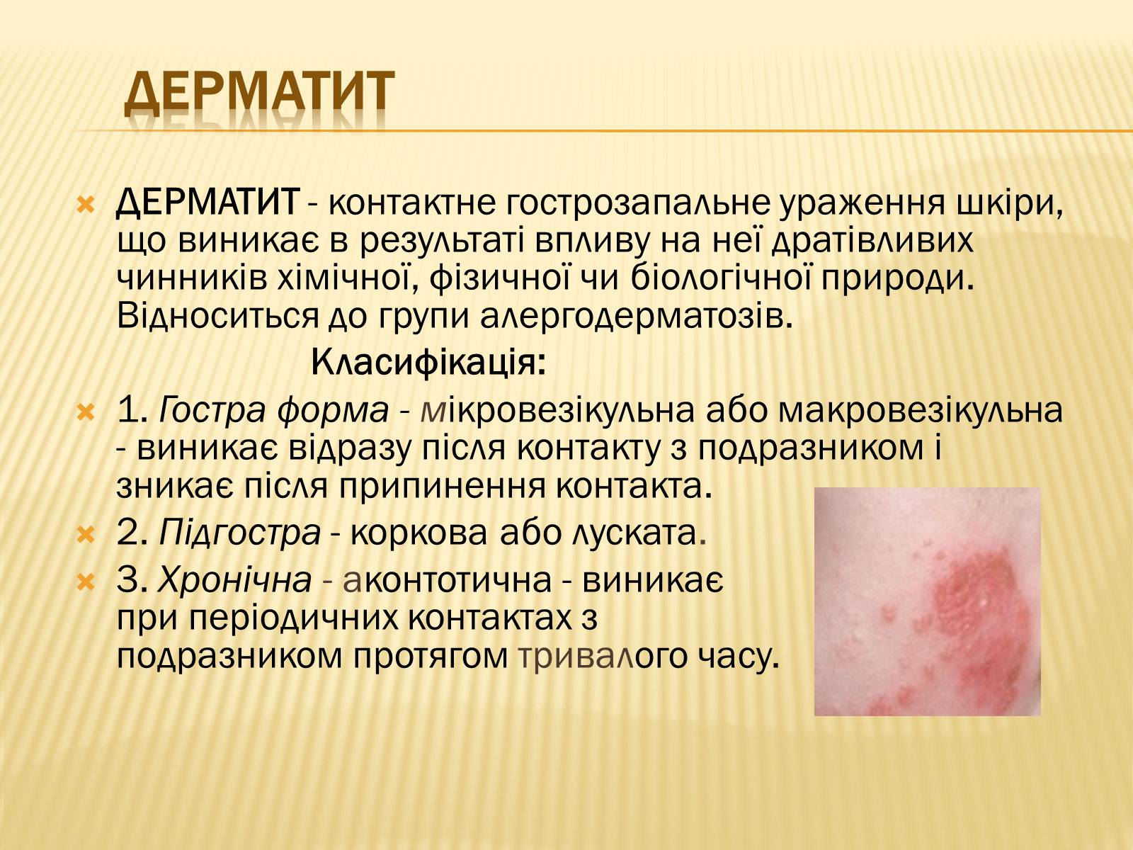 Презентація на тему «Хвороби шкіри» - Слайд #2