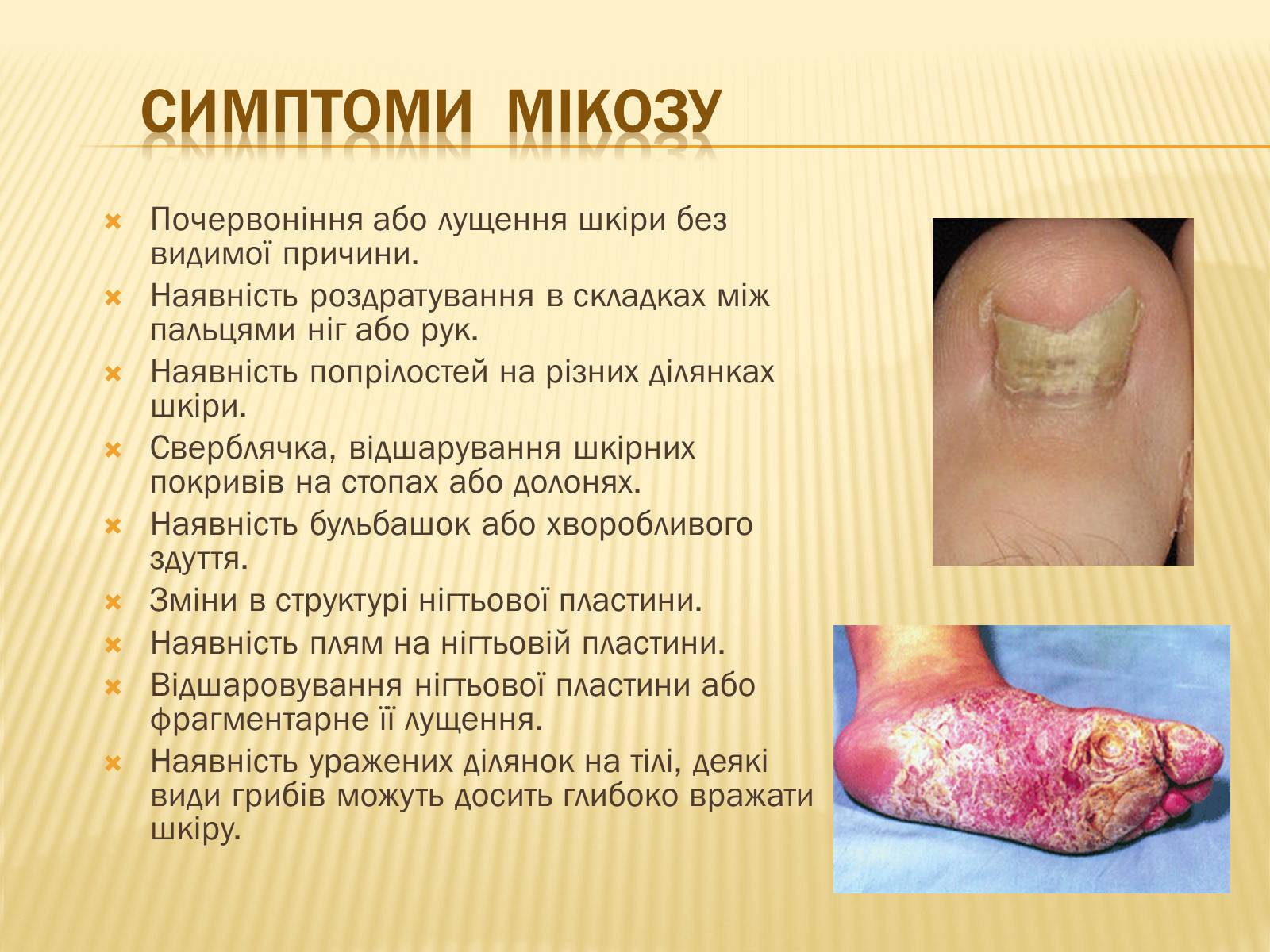 Презентація на тему «Хвороби шкіри» - Слайд #25
