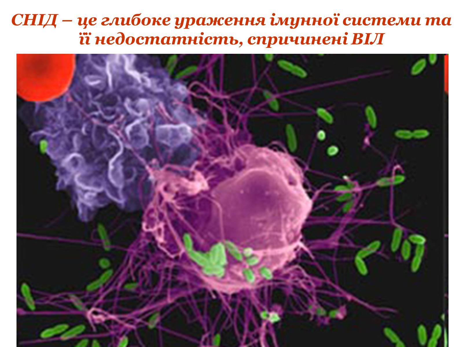 Презентація на тему «ВІЛ. СНІД. інфекції ІПСШ: шляхи передачі і методи захисту» (варіант 9) - Слайд #3