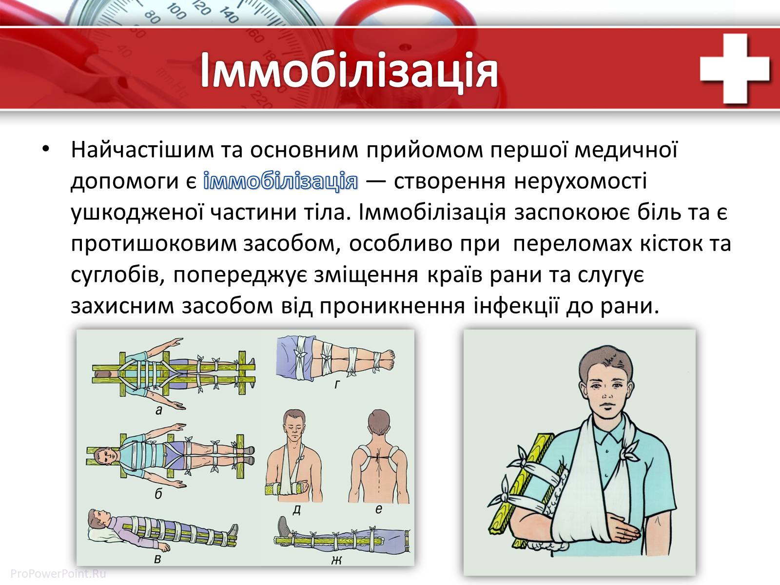 Презентація на тему «Перша медична допомога» (варіант 1) - Слайд #20