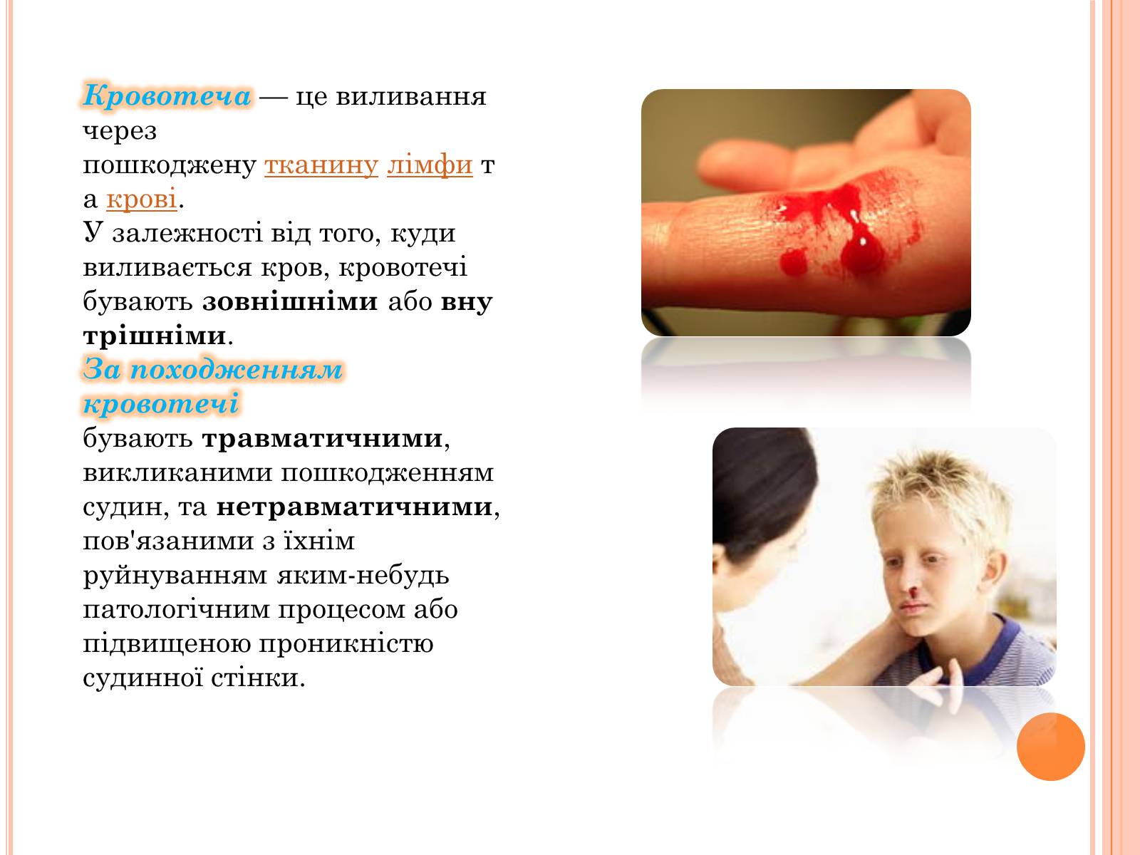 Презентація на тему «Кровотеча та надання першої допомоги при кровотечі» - Слайд #2