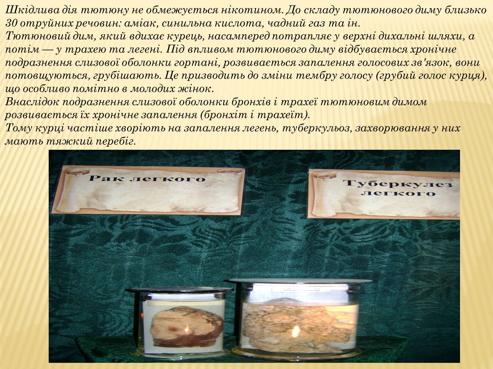 Презентація на тему «Шкідливий вплив уживання алкоголю, наркотичних речовин, тютюнокуріння на організм людини» - Слайд #13