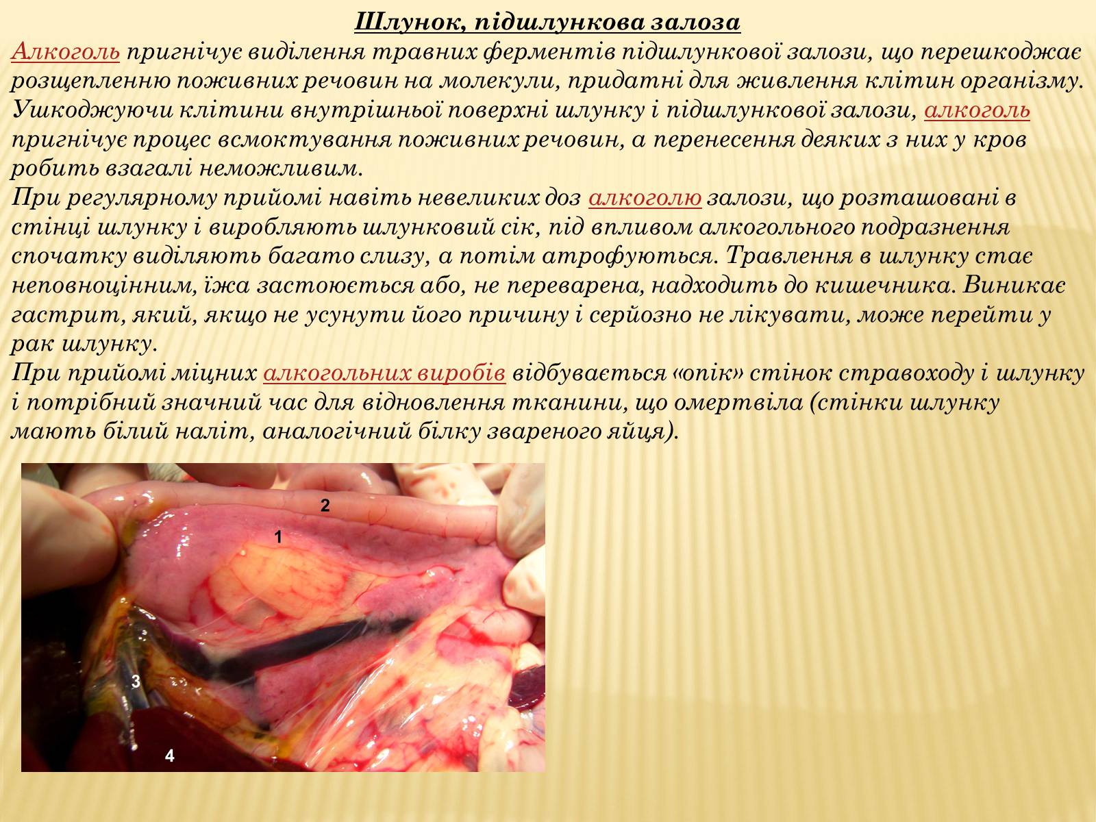 Презентація на тему «Шкідливий вплив уживання алкоголю, наркотичних речовин, тютюнокуріння на організм людини» - Слайд #4