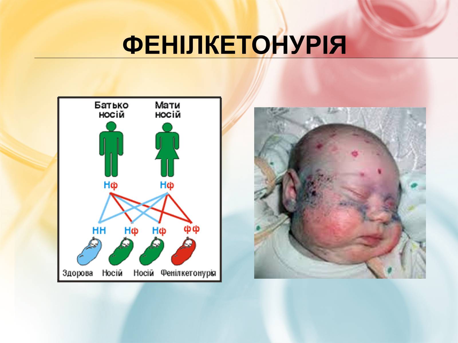 Презентація на тему «Хромосомна теорія спадковості» (варіант 3) - Слайд #16