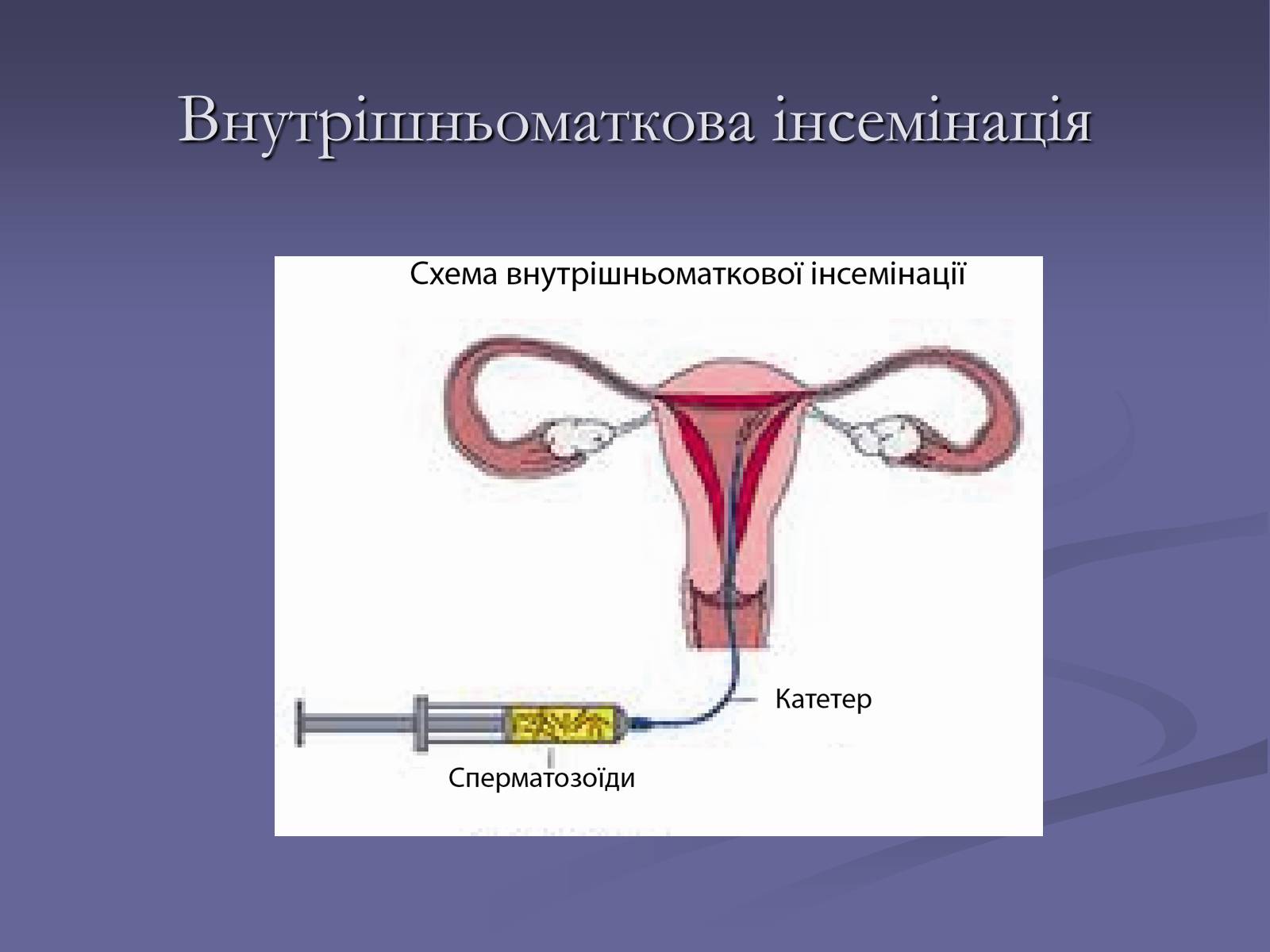 Презентація на тему «ШТУЧНЕ ЗАПЛІДНЕННЯ» - Слайд #3