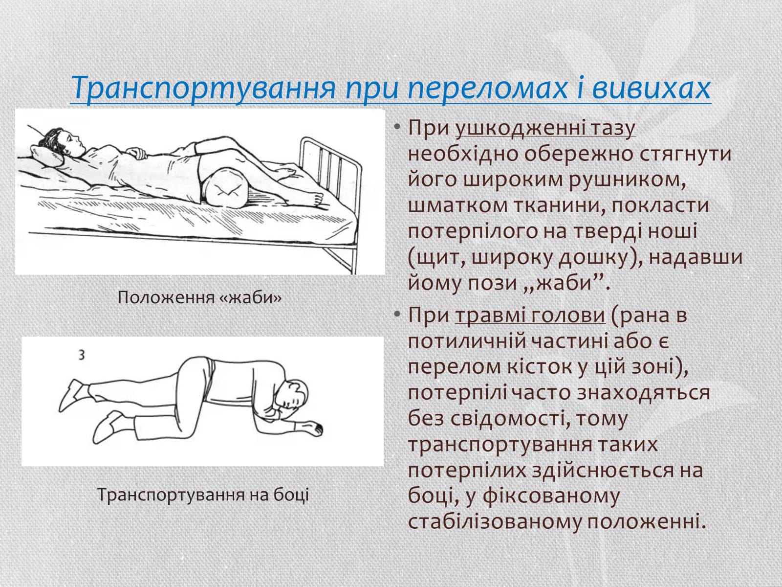 Первая при перелом кости таза. Транспортировка при переломе таза.