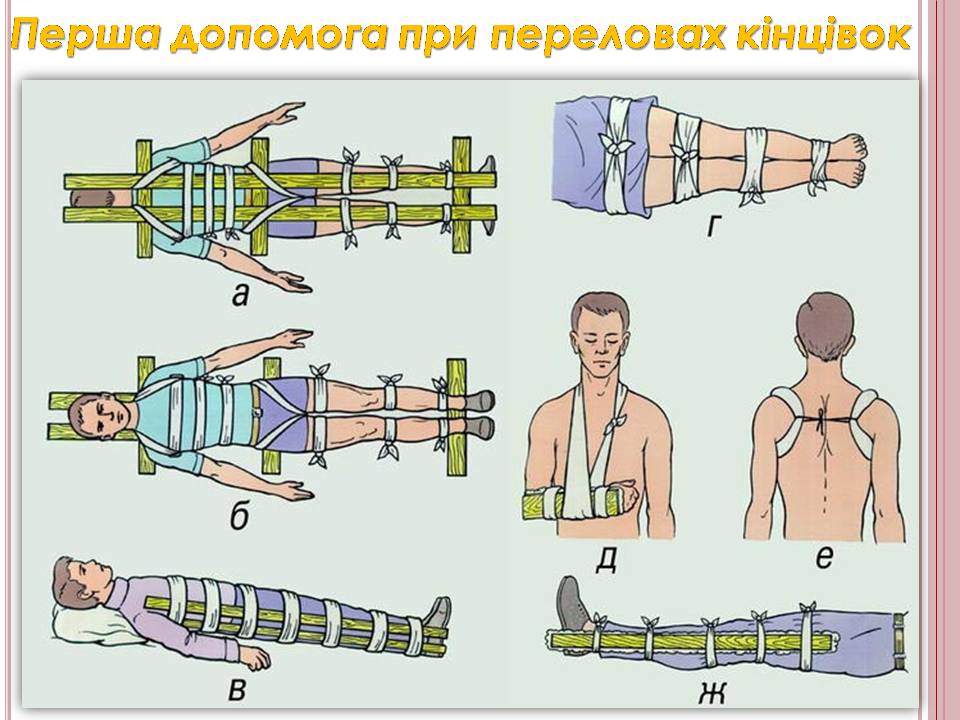 Презентація на тему «Надання першої медичної допомоги» - Слайд #9