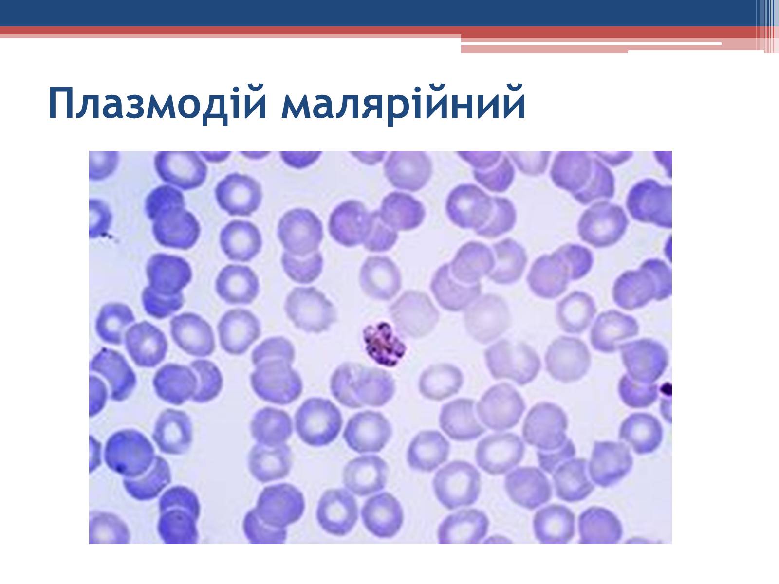 Презентація на тему «Хвороби людини, що викликаються одноклітинними тваринами» - Слайд #18