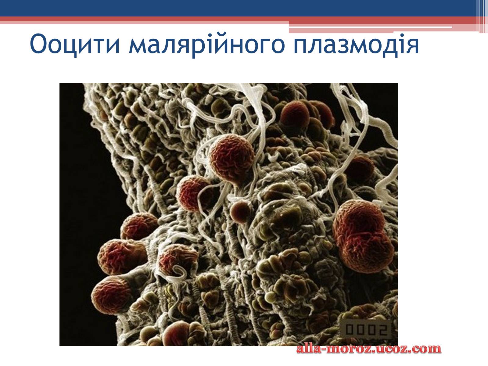 Презентація на тему «Хвороби людини, що викликаються одноклітинними тваринами» - Слайд #24