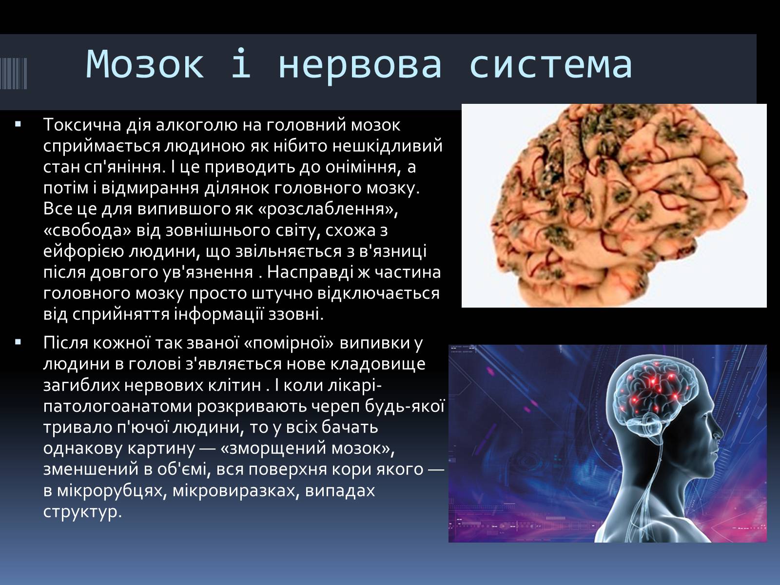 Презентація на тему «Вплив алкоголю на організм людини» (варіант 4) - Слайд #12