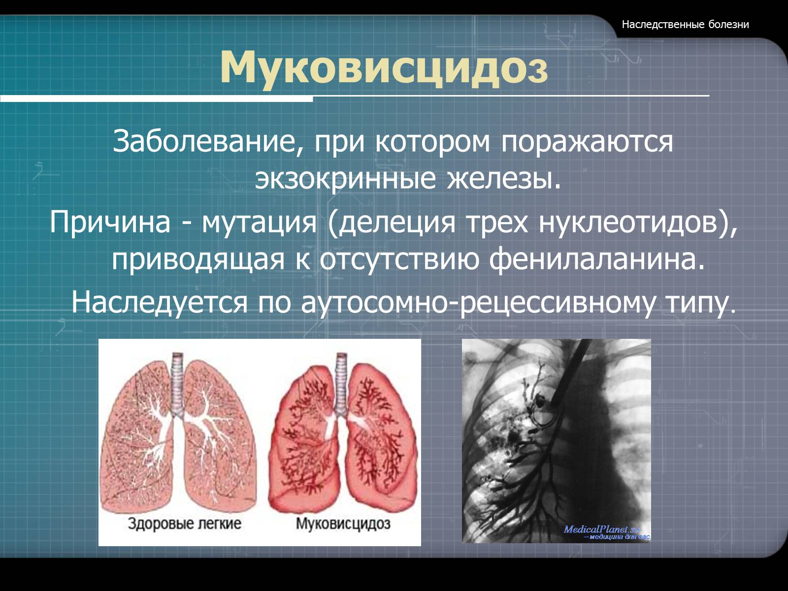 Презентація на тему «Наследственные болезни» - Слайд #9