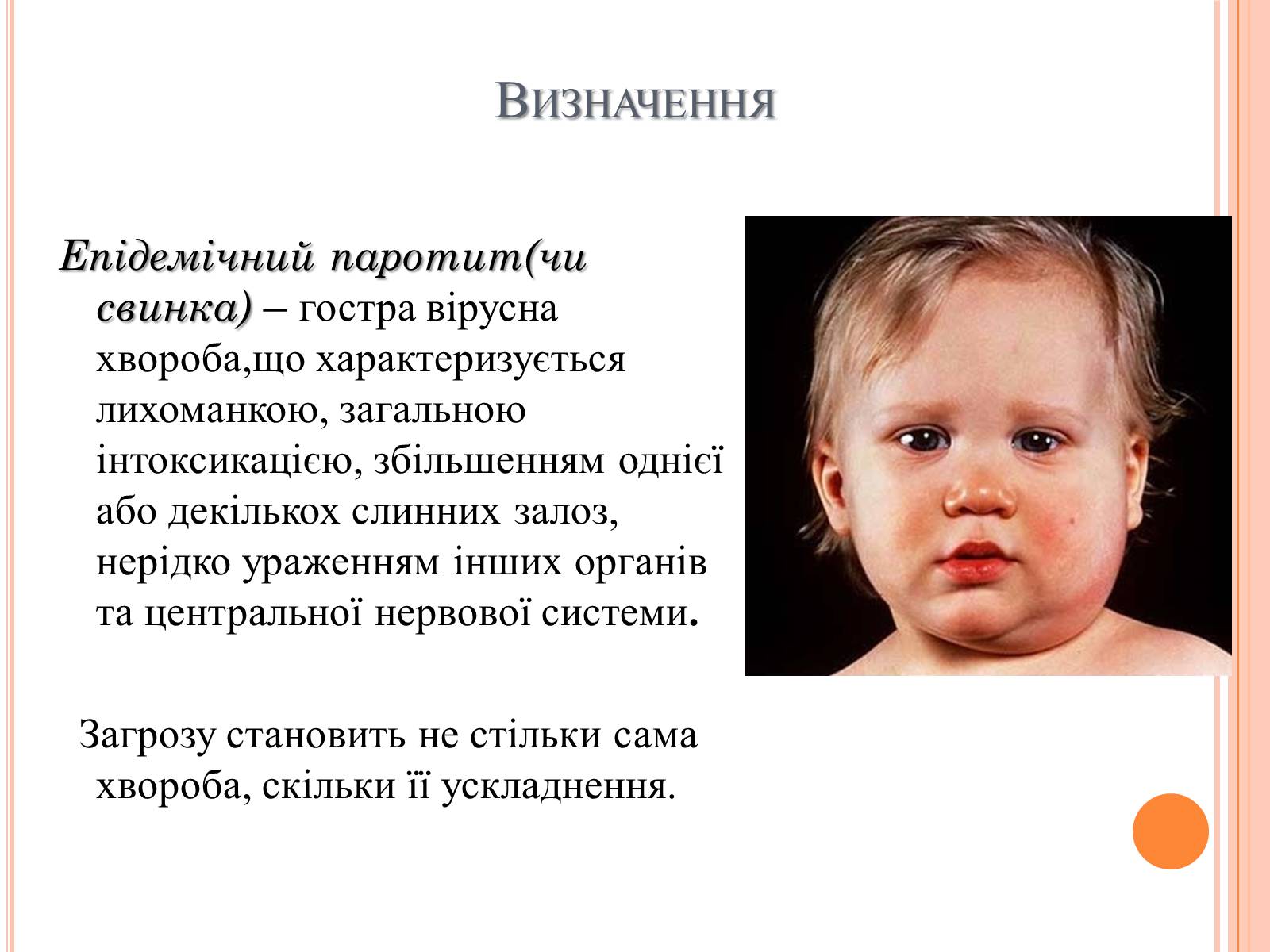 Презентація на тему «Епідемічний паротит» - Слайд #2