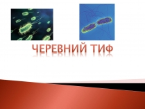 Презентація на тему «Черевний тиф»