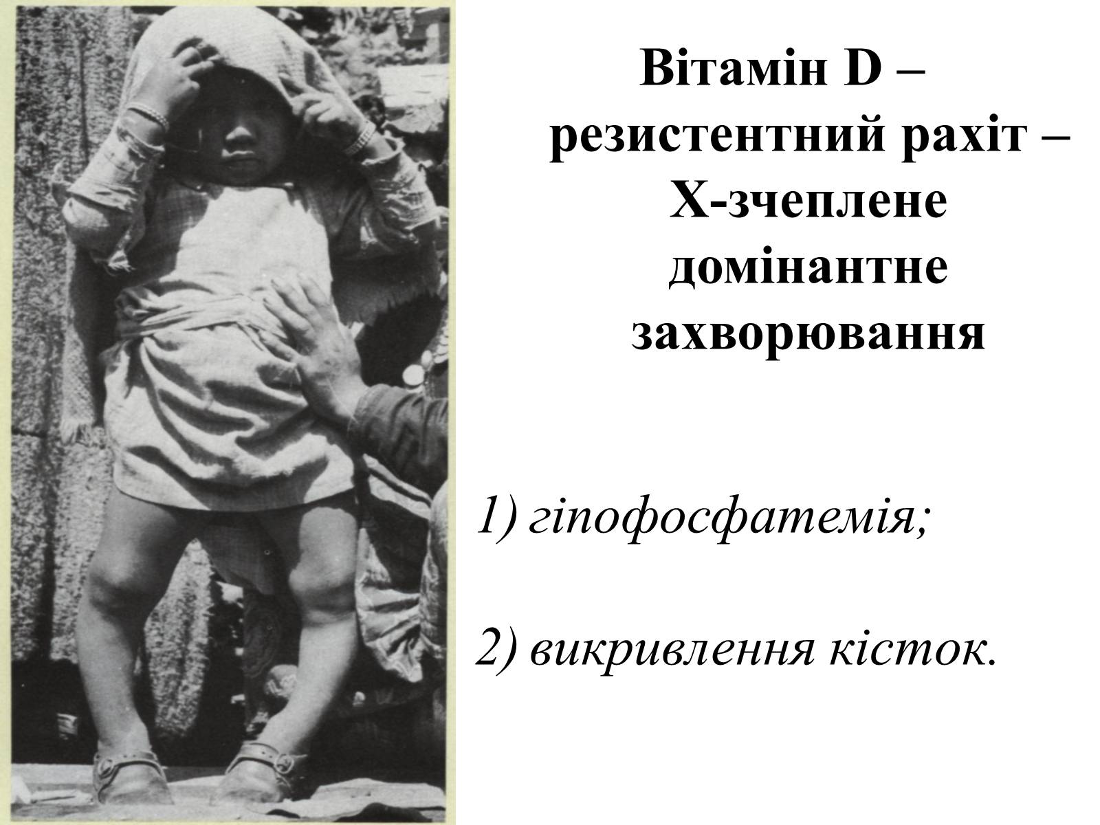 Презентація на тему «Успадкування статі та ознак, зчеплених зі статтю» - Слайд #27